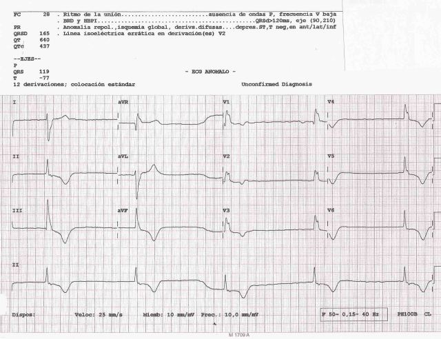 caso 135 EKG 1